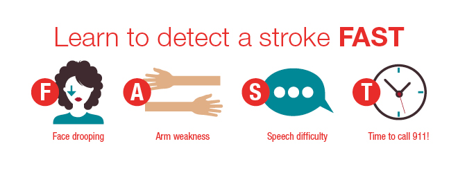 Learn to detect a stroke FAST