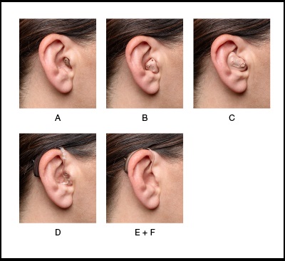 Hearing Aid Types