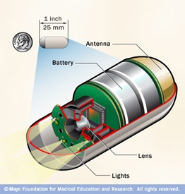 capsule endoscopy