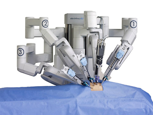 da Vinci robotic surgery