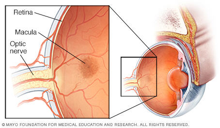 Eye Health Information - Fairmont - Mayo Clinic Health System