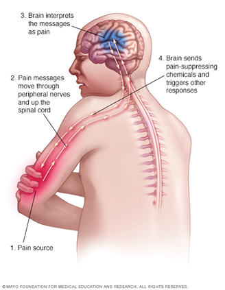 PainMedicine