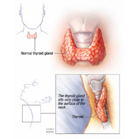 What is thyroid disease