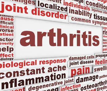 Arthritis