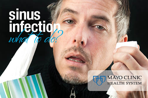 Will My Sinus Infection Clear Up On Its Own Mayo Clinic Health System Will My Sinus Infection Clear Up On Its Own Mayo Clinic Health System