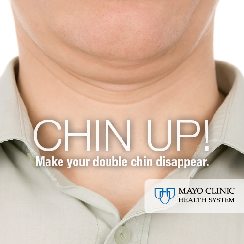 Cryolipolysis at Mayo Clinic Health System can help make your double chin disappear.