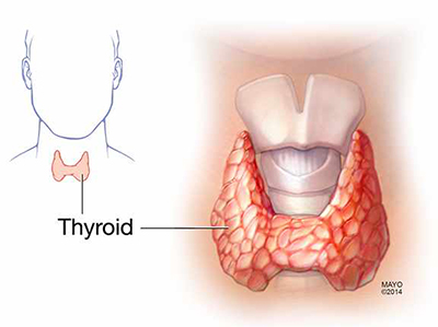 thyroidmedicalillustration