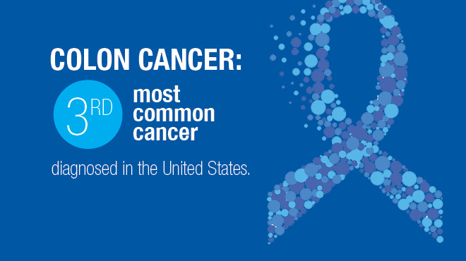 Colon cancer is the third most common cancer in the U.S.