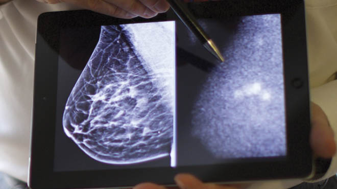 Dense breast tissue imaging