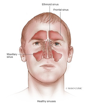 Sinus illustration