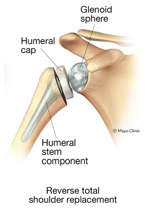 Replacement Revelations: Transforming the Ordinary into Extraordinary