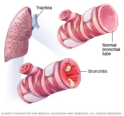 Pulmonary Conditions We Treat Mankato Mayo Clinic Health System Pulmonary Conditions We Treat Mankato Mayo Clinic Health System