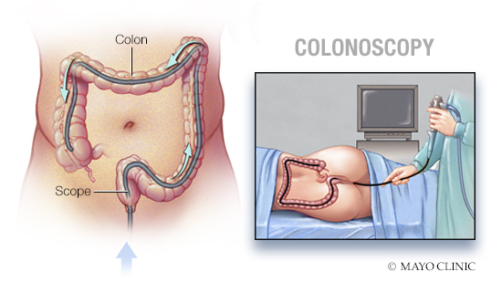 Digestive tests/procedures, Sparta - Mayo Clinic Health System